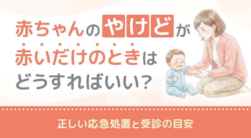 赤ちゃんのやけどが赤いだけのときはどうすればいい？正しい応急処置と受診の目安