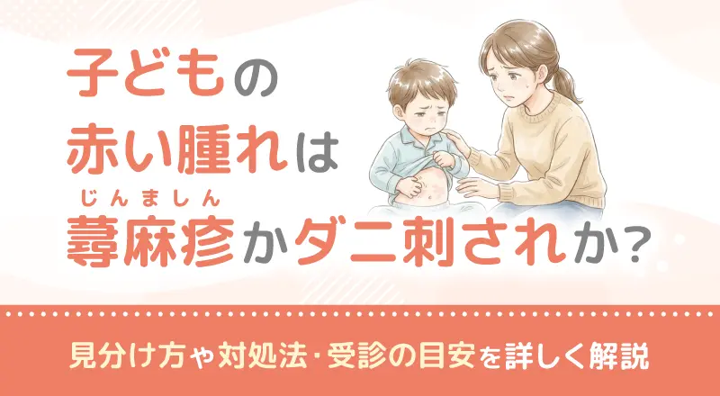 子どもの赤い腫れは蕁麻疹(じんましん)かダニ刺されか?見分け方や対処法・受診の目安を詳しく解説