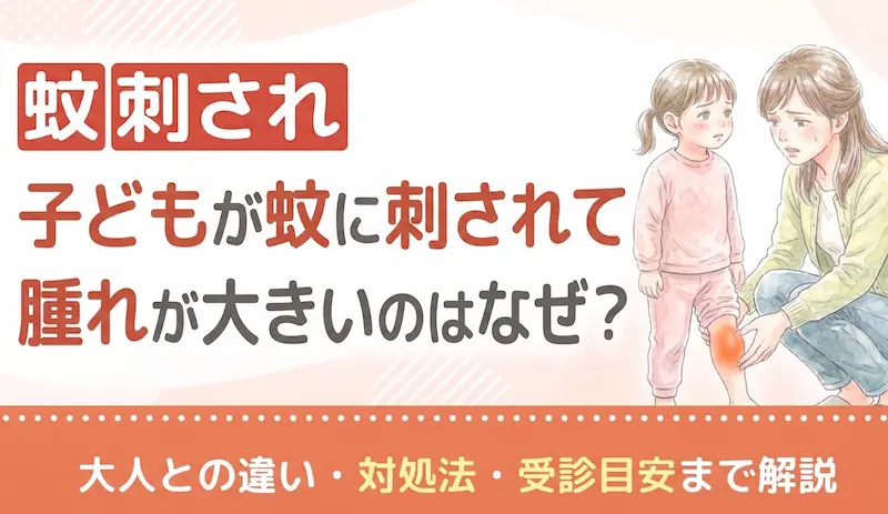 子どもが蚊に刺されて腫れが大きいのはなぜ?大人との違い・対処法・受診目安まで解説