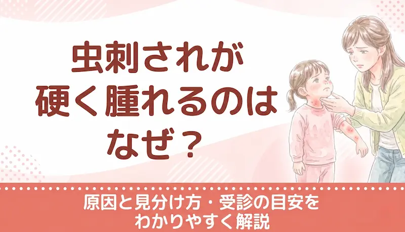 虫刺されが硬く腫れるのはなぜ?原因と見分け方・受診の目安をわかりやすく解説