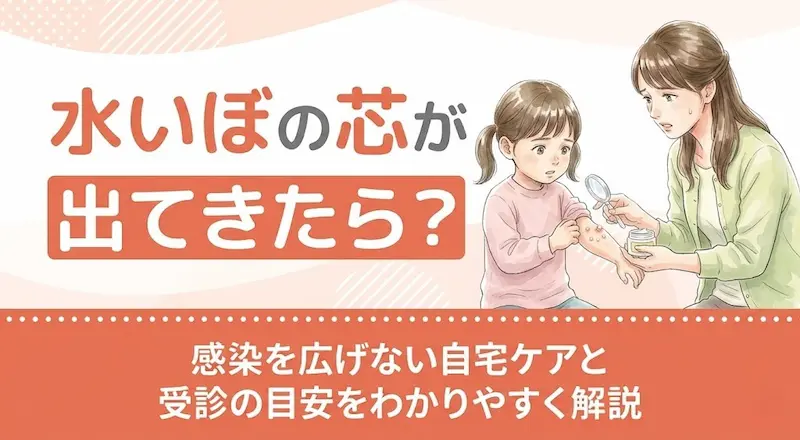 水いぼの芯が出てきたら?感染を広げない自宅ケアと受診の目安をわかりやすく解説
