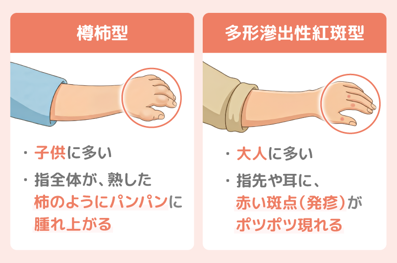 樽柿型、多形滲出性紅斑型