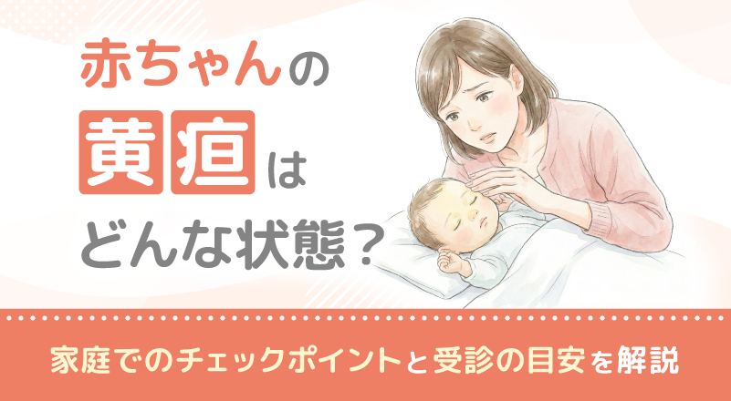 赤ちゃんの黄疸はどんな状態？家庭でのチェックポイントと受診の目安を解説
