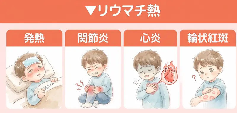リウマチ熱_イメージ図