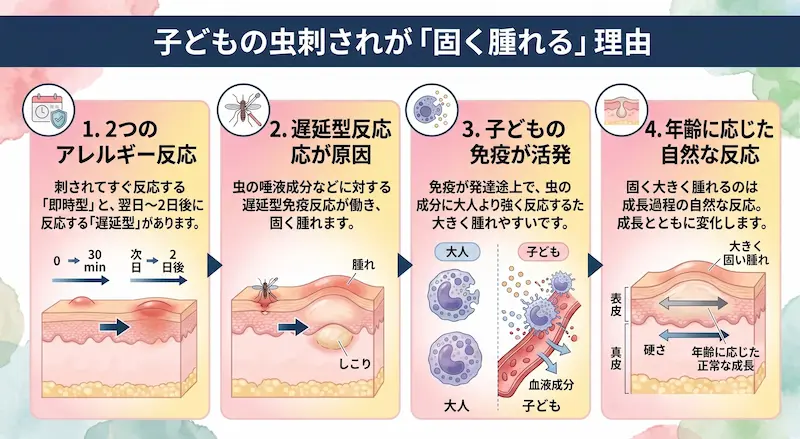 虫刺されが硬く腫れるのは「遅延型アレルギー反応」が関係しています