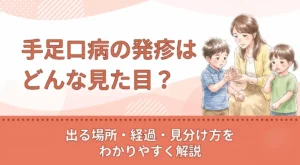 手足口病の発疹はどんな見た目？出る場所・経過・見分け方をわかりやすく解説