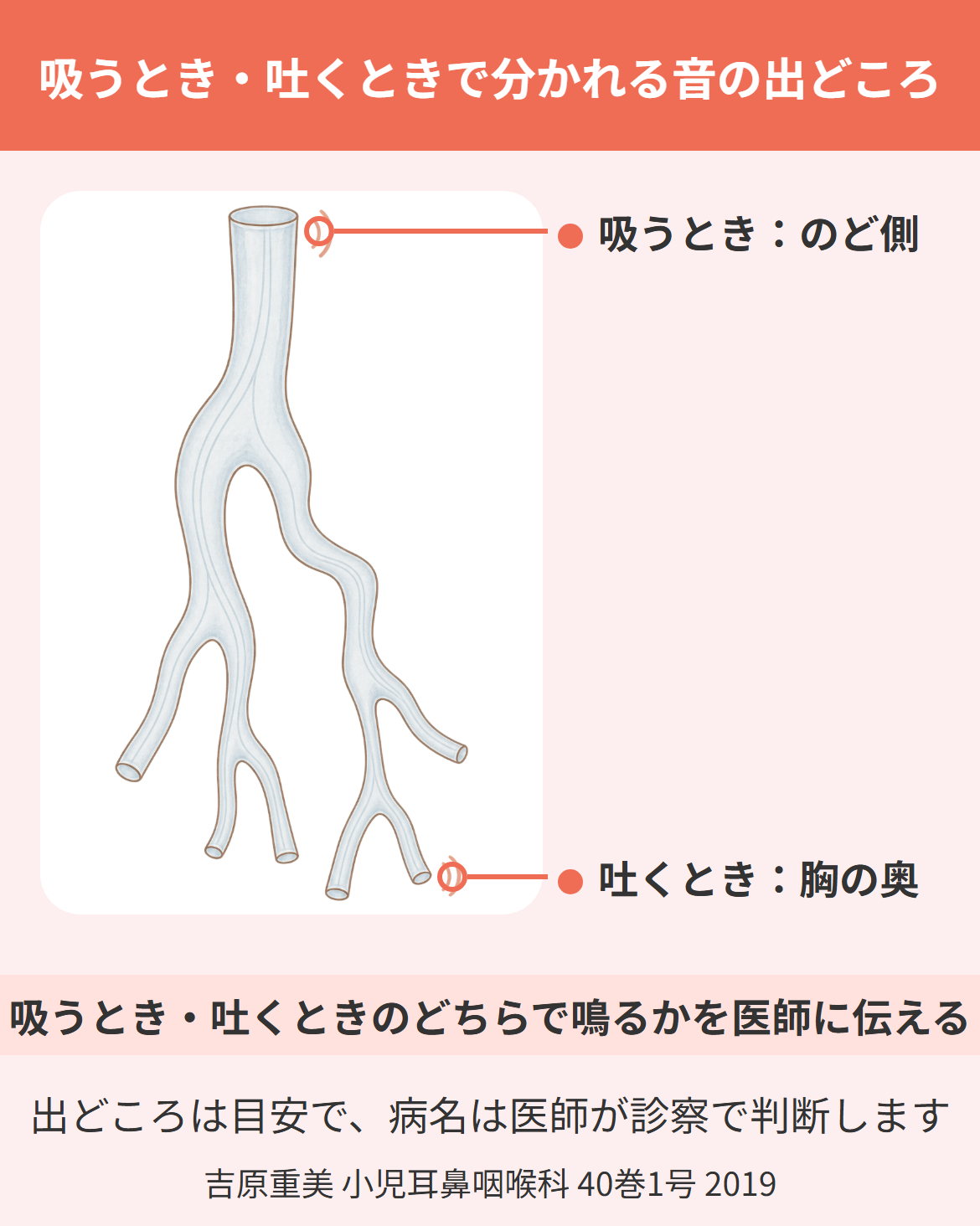 赤ちゃんのゼーゼー・ヒューヒューという息の音の出どころを枝分かれした管にたとえ、吸うときの音はのど側、吐くときの音は胸の奥が目安で、どちらで鳴るかを医師に伝えることを示した図