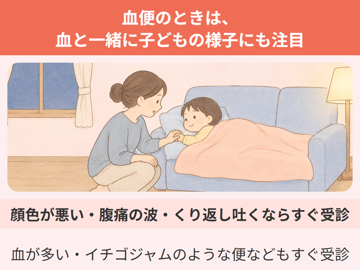子どもの血便では、血と一緒に子どもの様子も見て、ぐったり・強い腹痛の波・何度も吐く・血が多いときはすぐ受診することを示したイラスト