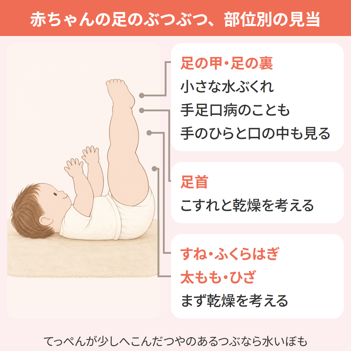 赤ちゃんの足のぶつぶつを、足首・足の甲と足の裏・すね・太ももの部位別に見る図