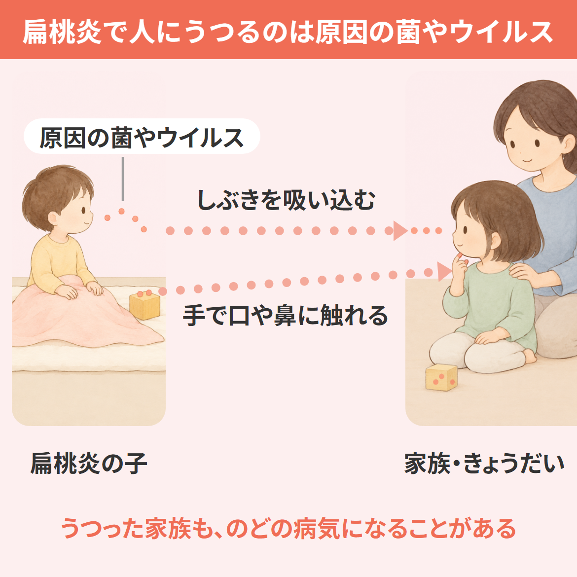 扁桃炎でうつるのは炎症そのものではなく原因の菌やウイルスで、うつっても全員が発症するとは限らないことを示す関係図