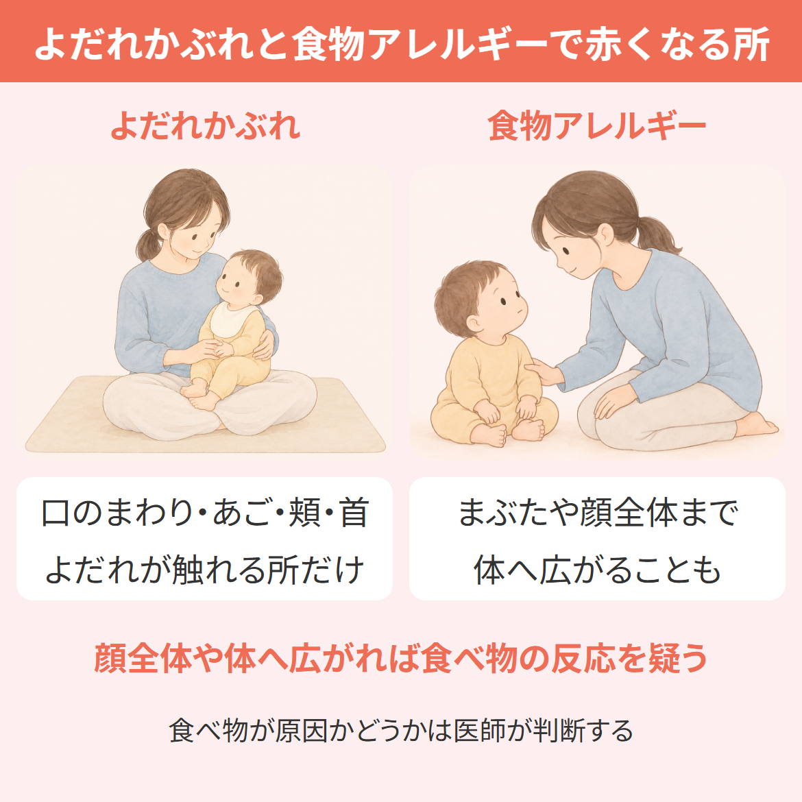 よだれかぶれと食物アレルギーで赤くなりやすい場所を比べた図。よだれかぶれは口のまわり・あご・頬・首など、よだれや食べこぼしが触れる所だけに出やすく、食べ物の反応はまぶたや顔全体まで、体へ広がることがある。食べ物が原因かどうかは医師が判断する